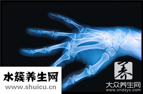 視神經脊髓炎癥狀