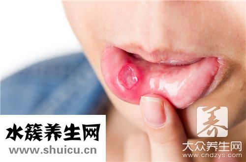 口腔厭氧菌感染癥狀