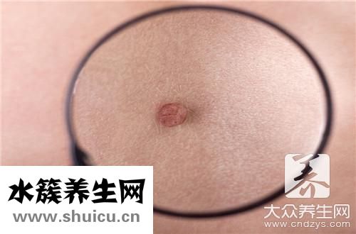 臉上總是反復長痘痘