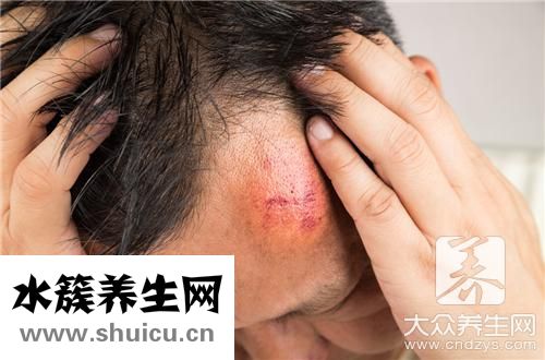 劇烈運動后頭暈