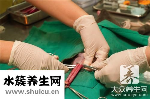 腕管綜合征手術費用