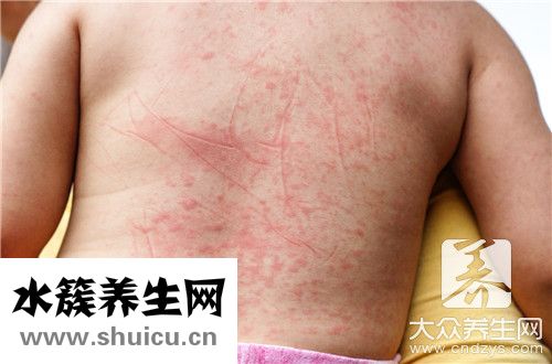 氣滯血瘀最好中成藥