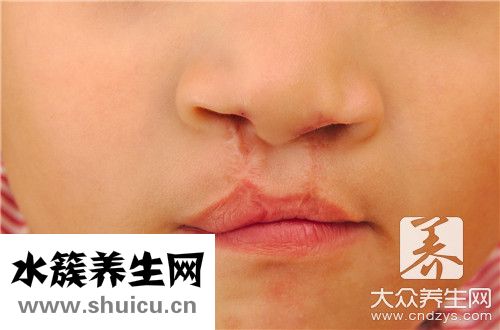 上唇系帶斷裂危害