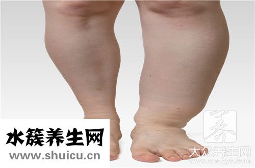 去水腫方法