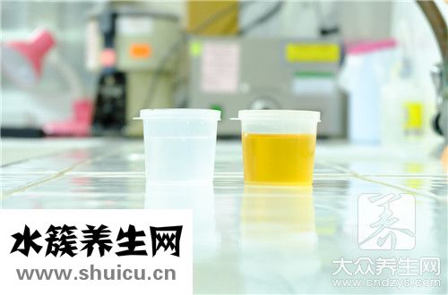 正常尿液泡沫同