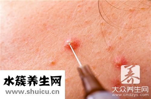 吃什么食物散結節最快