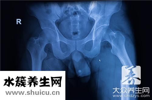 電刺激盆底肌治療危害