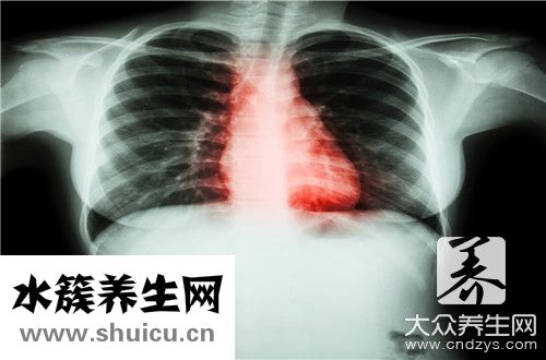 輕度三尖瓣反流