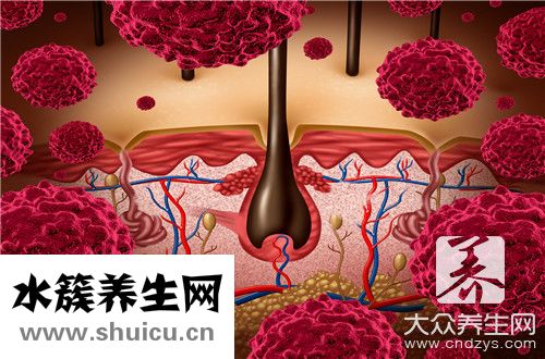 毛囊炎涂什么藥膏最好