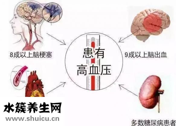 缺血性中風(fēng)