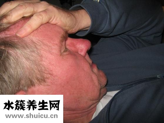 什么是多囊卵巢