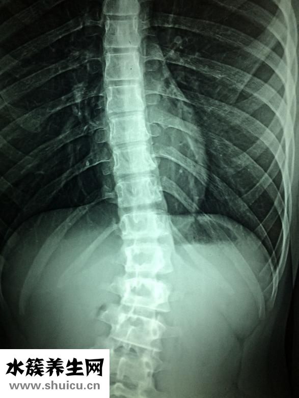 槐花的功效與作用