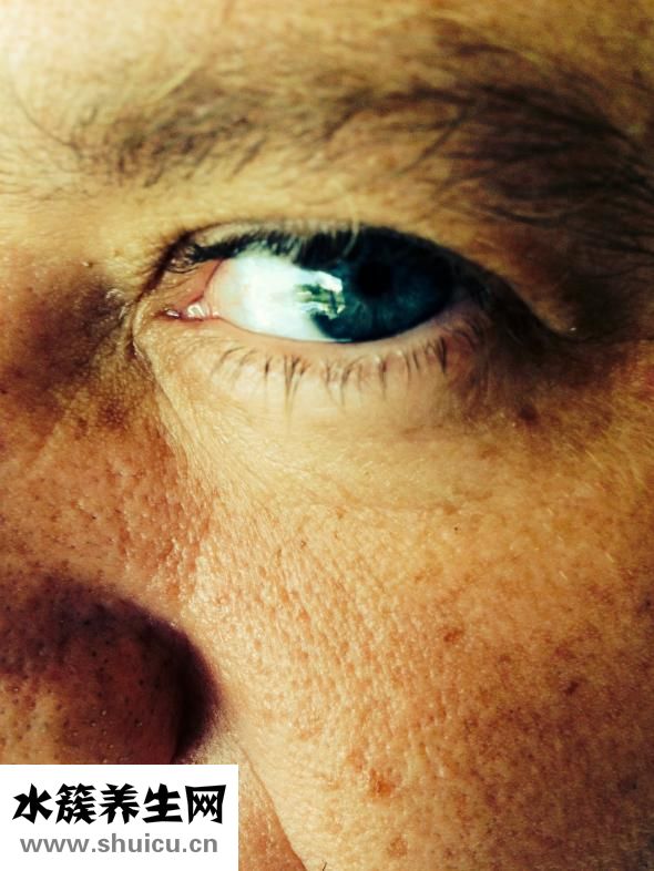 嬰兒抽搐癥狀表現