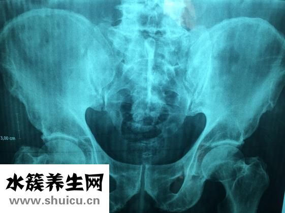 雙唑泰栓的功效