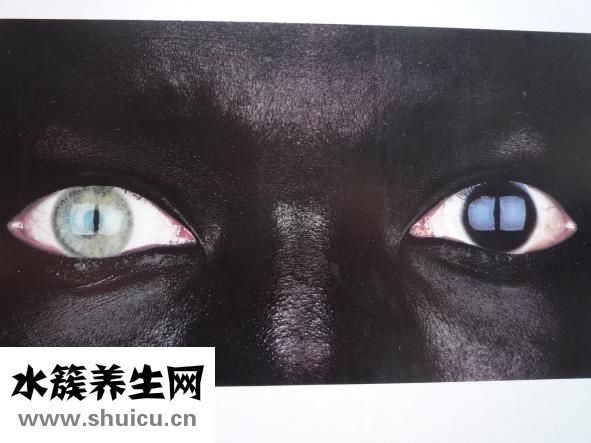 早上起床眼睛浮腫