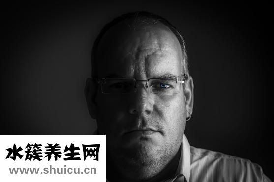 色素性毛表皮痣