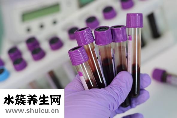 血栓性淺靜脈炎