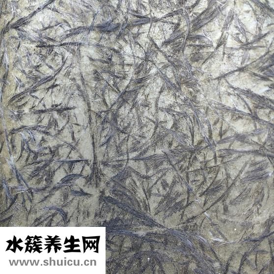 纖維囊性乳腺病