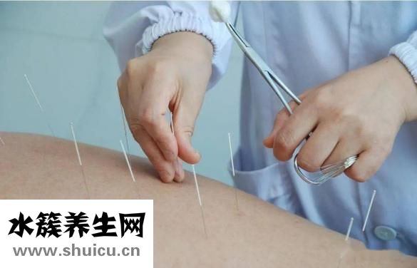 腰間盤突出針灸