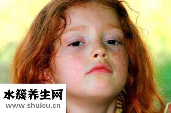 紅血絲怎么去除