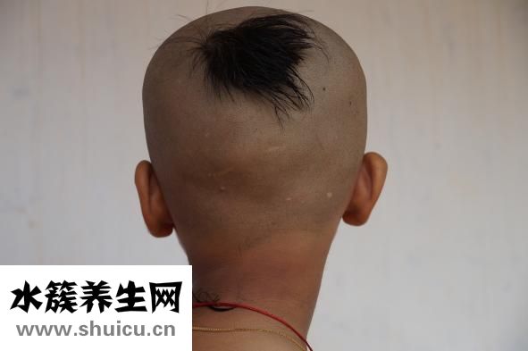 皮膚毛孔大怎么辦