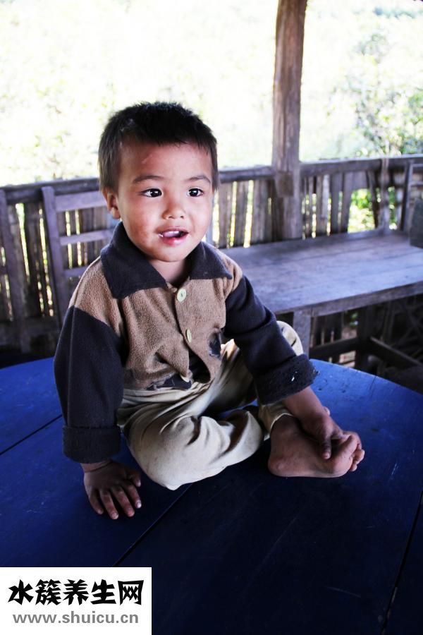 小孩黑眼圈怎么回事