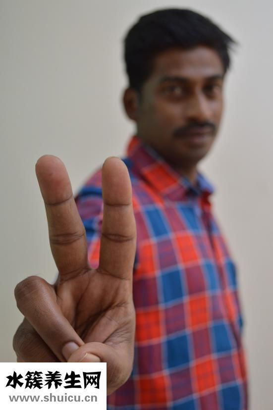 臉火辣辣的疼怎么辦