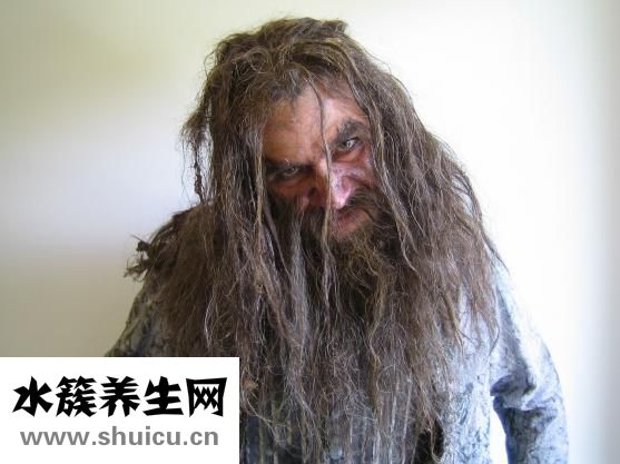 新生兒頭皮屑怎么弄