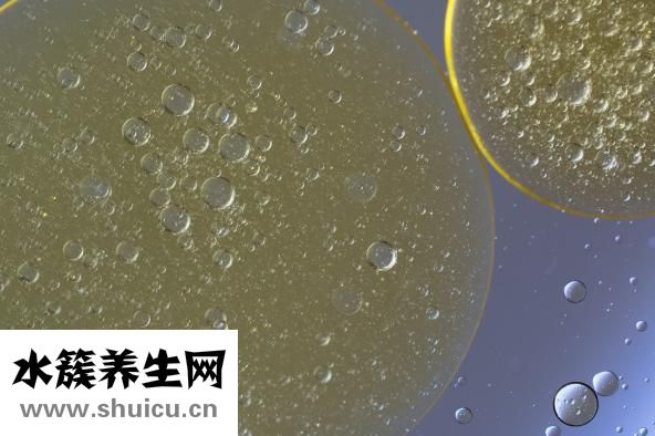 頭皮總出油怎么辦