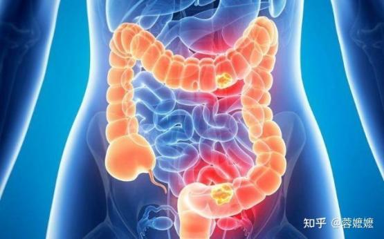 調理腸胃的10個好方法，調理腸胃的10個好方法腸胃不好的人可以吃野生蜜嗎