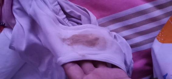 正常的白帶顏色有4圖,內褲上有黃黃的分泌物是怎么回事