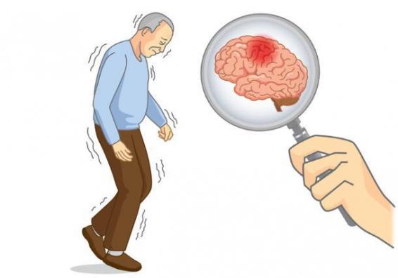 腦梗塞的最佳治療方法，腦梗塞的最佳治療方法康復訓練視頻