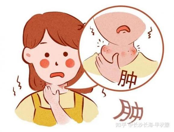 甲亢是怎么引起的，產(chǎn)后甲亢是怎么引起的