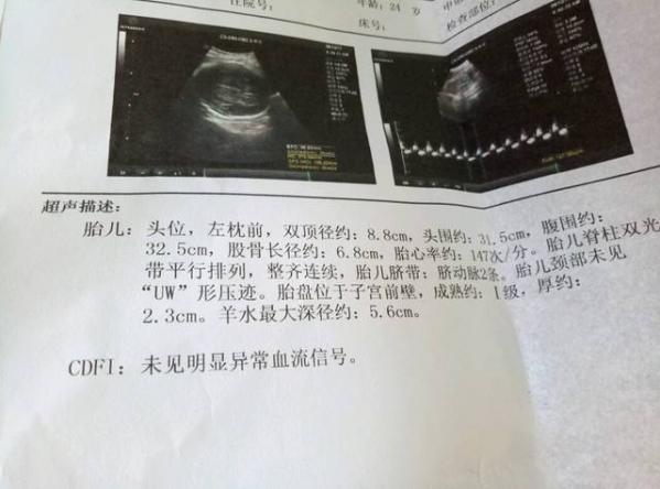 打一個月的胎兒要多少錢呢（打一個月的胎兒要多少錢）