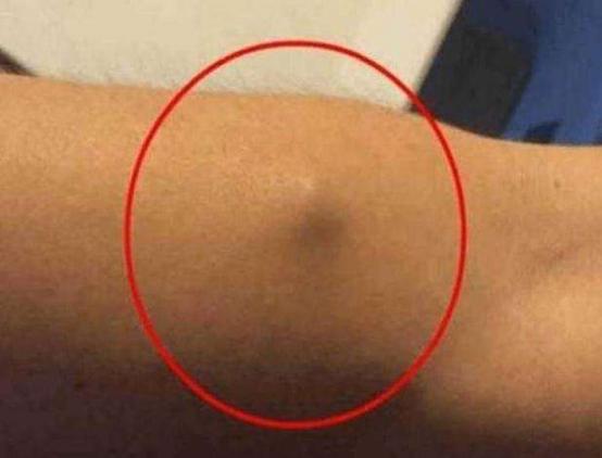 身體里長個小疙瘩摸著硬硬的(摸著硬硬的)