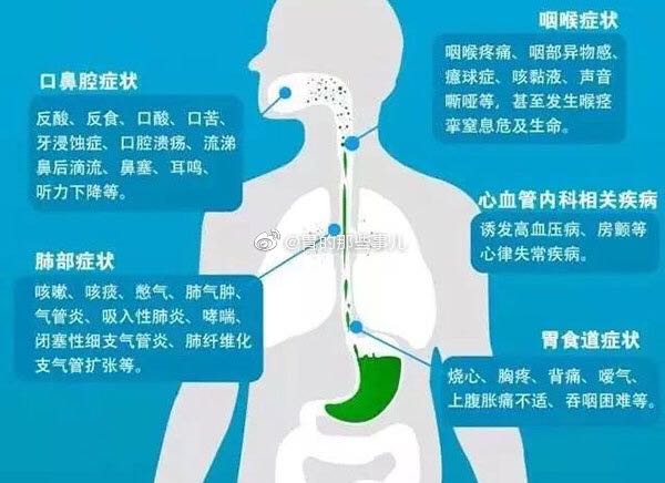 胃食管反流的主要癥狀怎么治療（胃食管反流的主要癥狀）