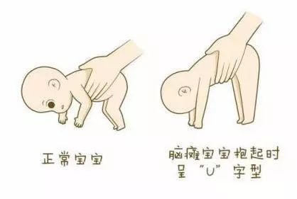 八個動作看寶寶腦癱圖六個多月的體重正常是多少(八個動作看寶寶腦癱圖)