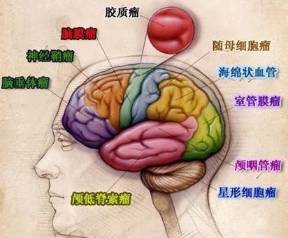 腦瘤早期的7個(gè)征兆頭皮一按就疼是怎么回事（腦瘤早期的7個(gè)征兆）