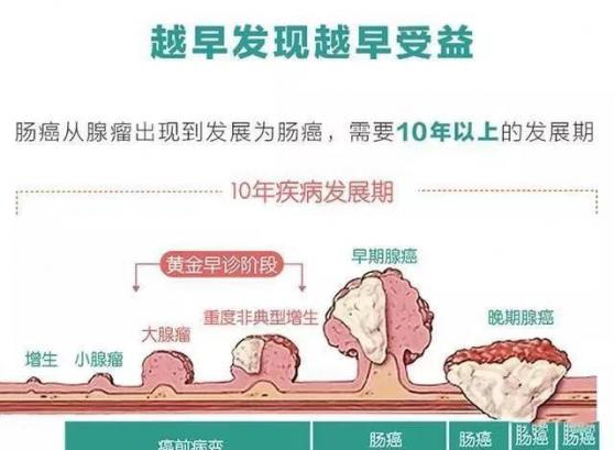 怎么判斷直腸出血還是痔瘡（便血多久算是初期腸癌）