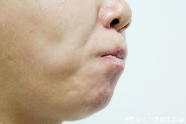 吃維生素b2多久乳房會變大（下邊干澀吃維生素b2管用嗎）