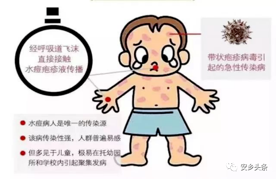 女人得性疾病初期什么癥狀(被傳染性疾病多久會有癥狀)