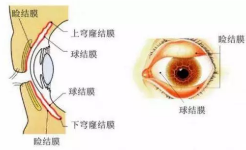 結(jié)膜炎能自愈嗎（結(jié)膜炎能自愈嗎大概多久）