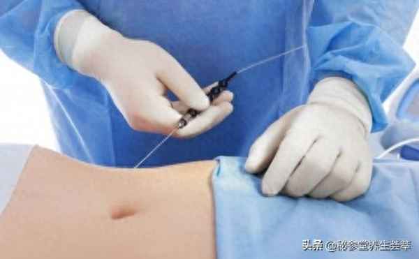 瘦身針多少錢一針（瘦身針多少錢一針有什么副作用）