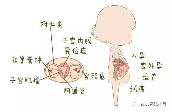 婦科霉菌是怎么引起的(女性霉菌是什么引起的)