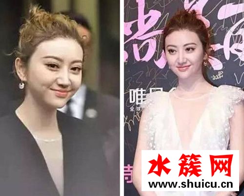趙麗穎變塑膠臉景甜胖成豬頭 女明星的臉這都怎么了?