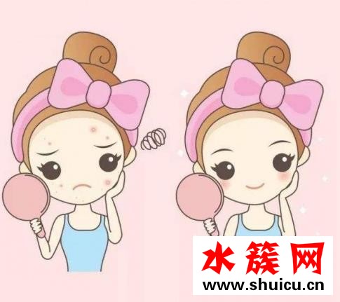 擒賊先擒王，了解痘痘形成的原因才能戰痘成功！