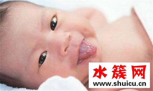寶寶舌苔厚白怎么回事 寶寶舌苔厚白怎么去掉 寶寶舌苔厚白怎么回事