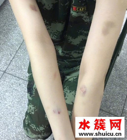 張馨予訓狗慘被咬是怎么回事