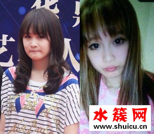 趙本山女兒球球承認整容