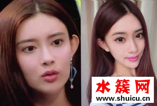 孟子義整容前后照片